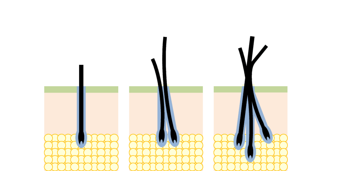 Hair Characteristics & Their Effects