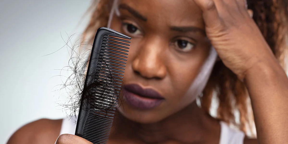 Excessive Hair Shedding