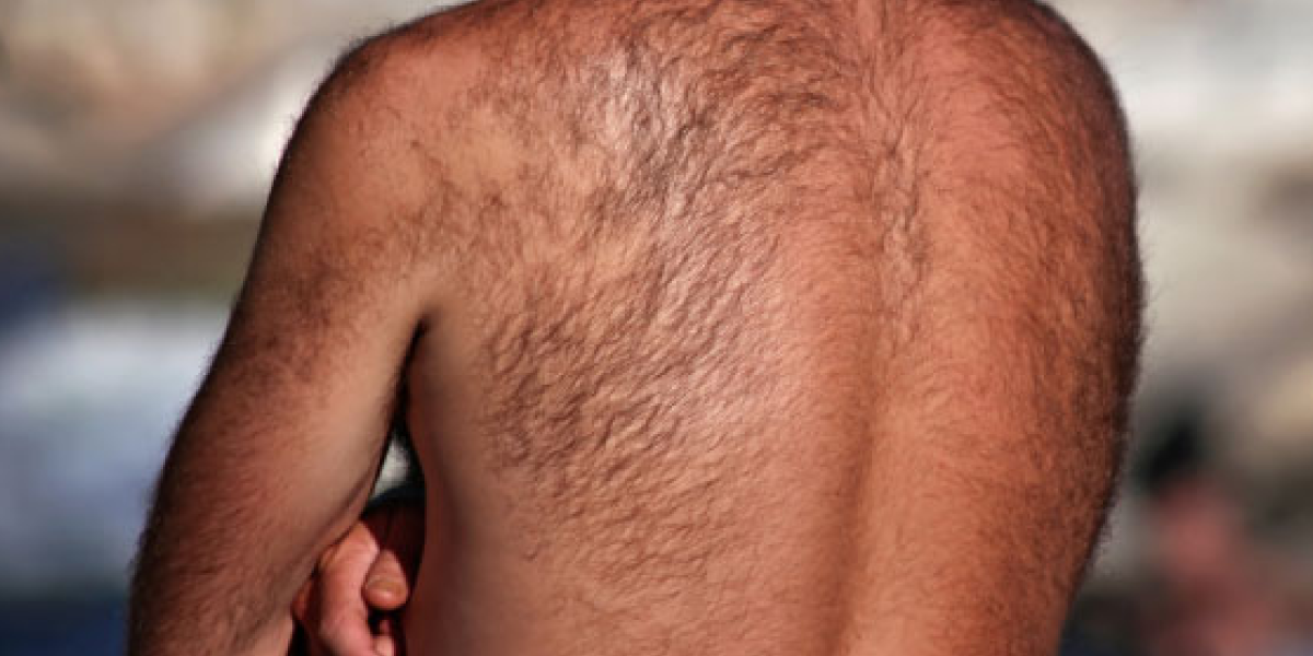 Loss of Body Hair