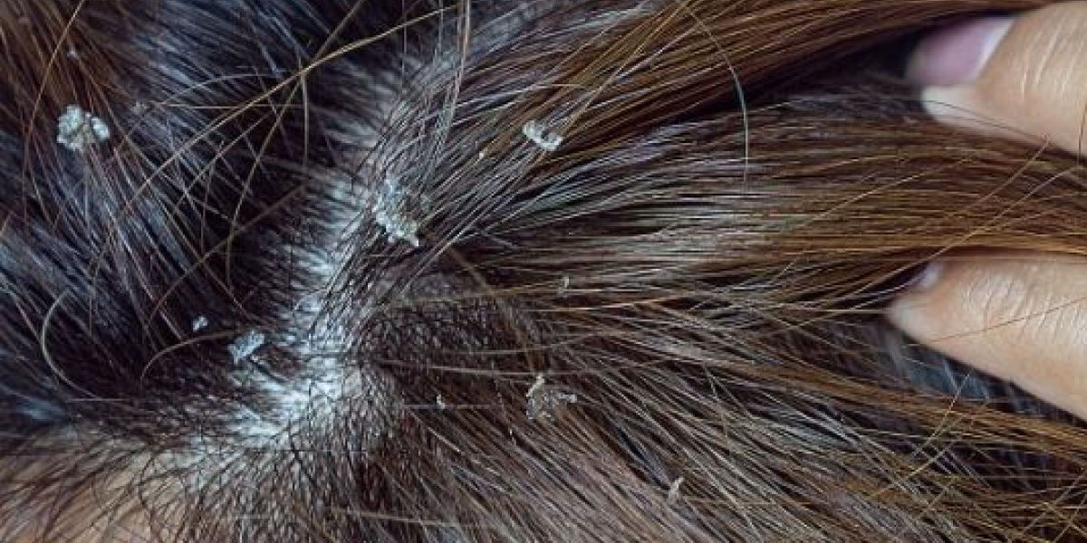 Smelly Hair