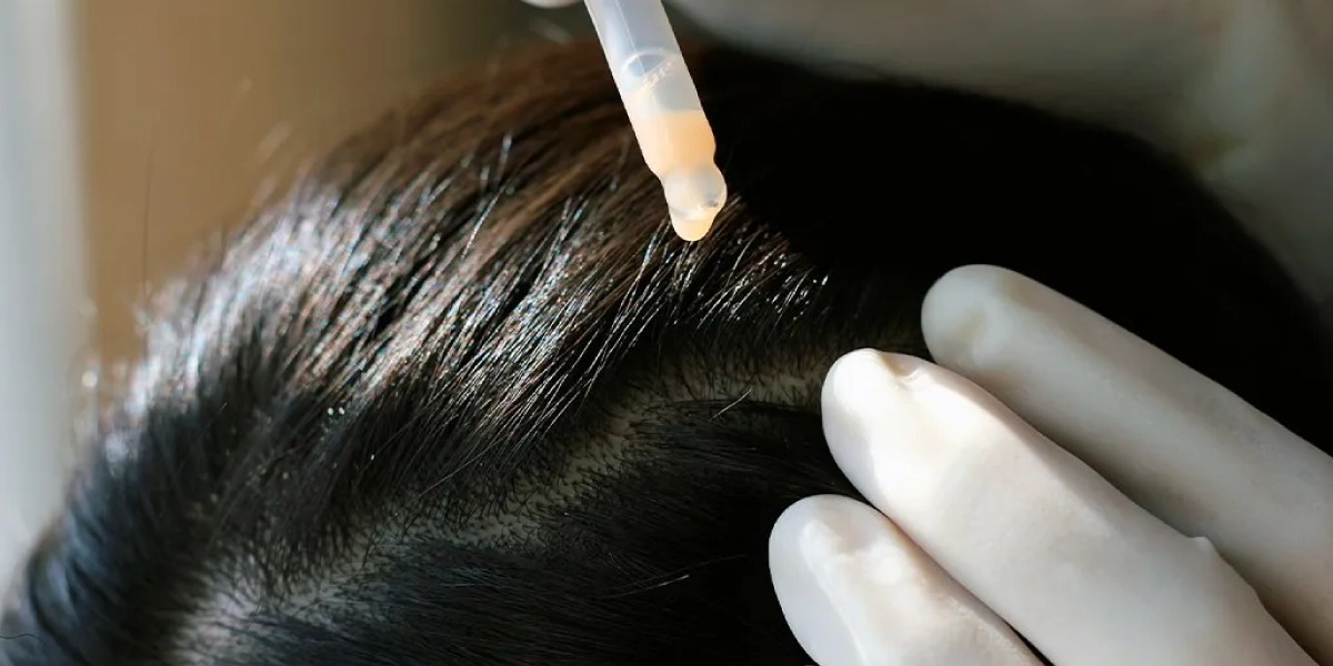 How to Use Scalp Treatment Products