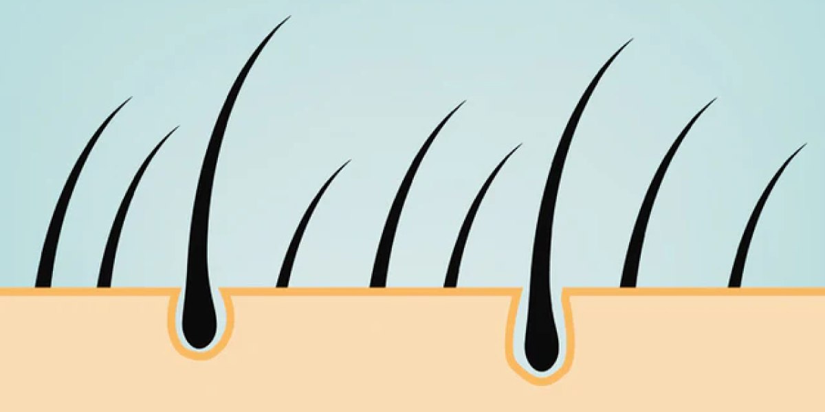 What is a Hair Follicle