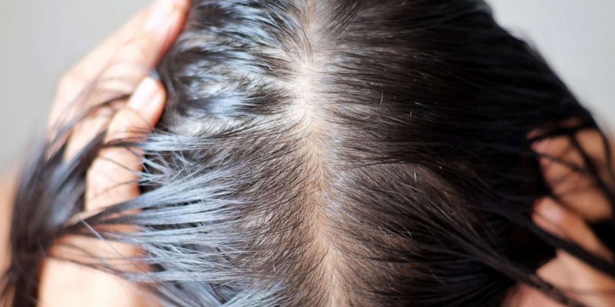 When to See a Dermatologist