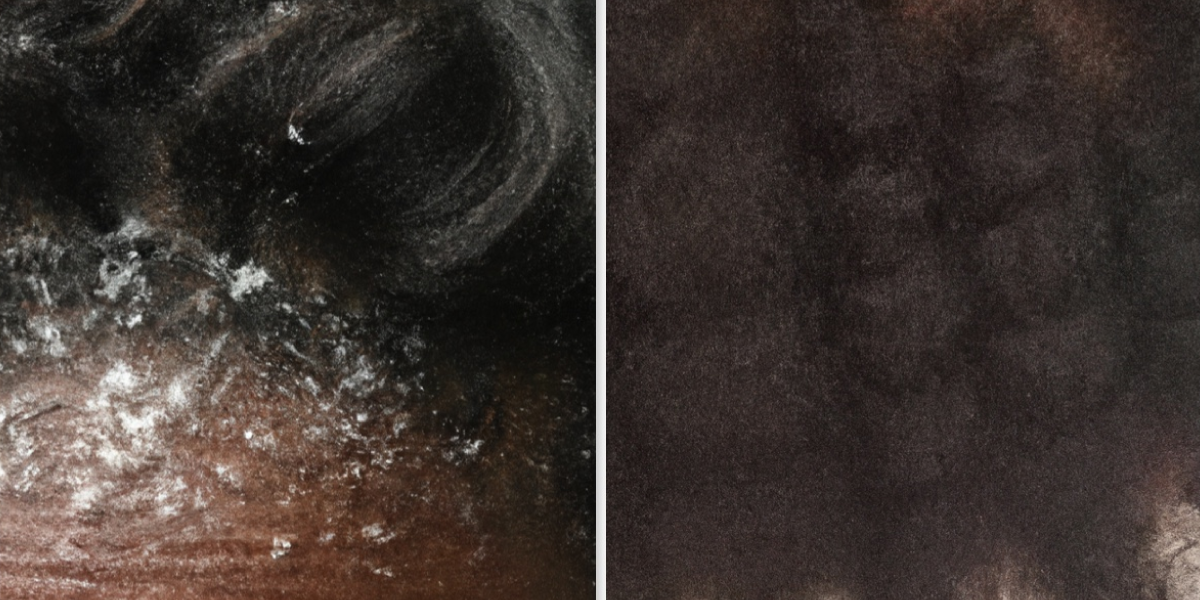 Can You Have Both Dandruff and Dry Scalp