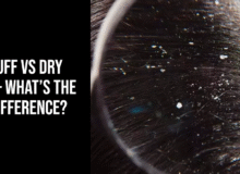 Dandruff vs Dry Scalp