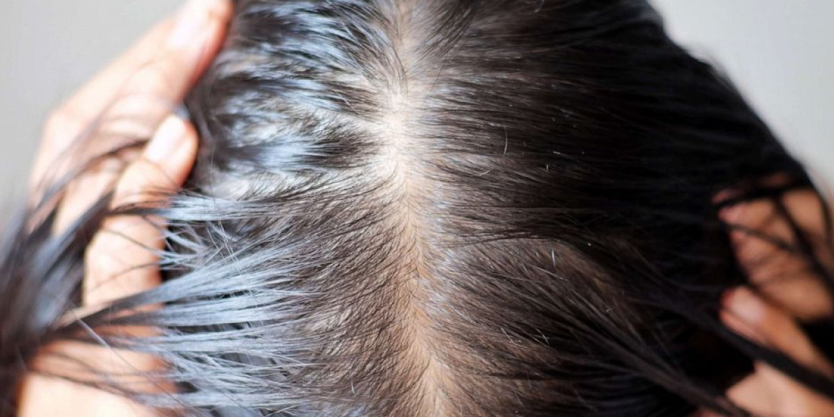 When to See a Doctor or Dermatologist for Hair Thinning