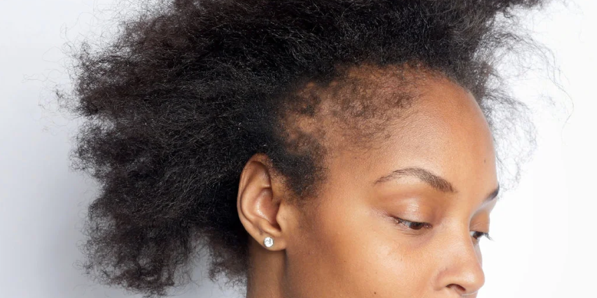 Why Understanding Thin Hair Matters