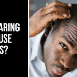 does wearing a hat cause baldness