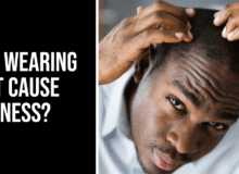 does wearing a hat cause baldness