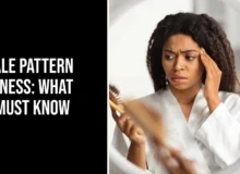 Female pattern baldness