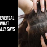 grey hair reversal