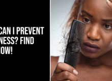 How can I prevent baldness