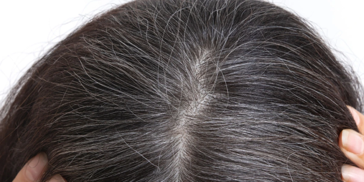 Natural Ways That May Help with the Grey Hair Reversal Process