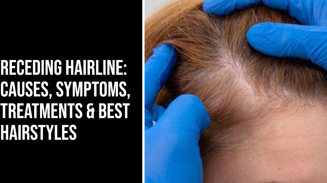 Receding Hairline: Causes, Symptoms, Treatments & Best Hairstyles