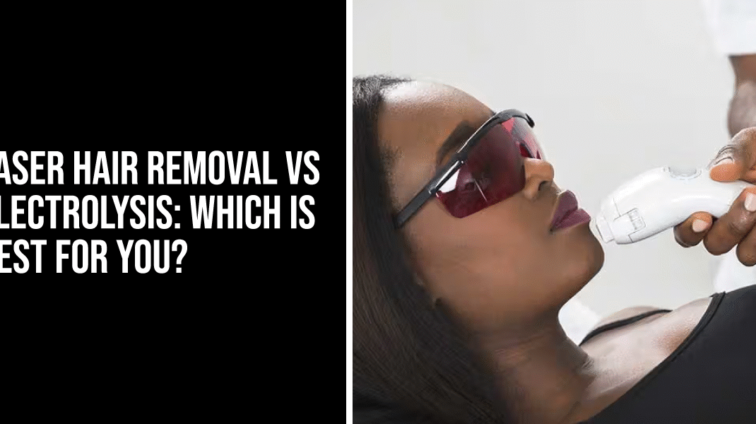 Laser Hair Removal vs Electrolysis: Which is Best for You