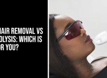 Laser Hair Removal vs Electrolysis: Which is Best for You