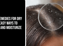 Home Remedies for Dry Scalp