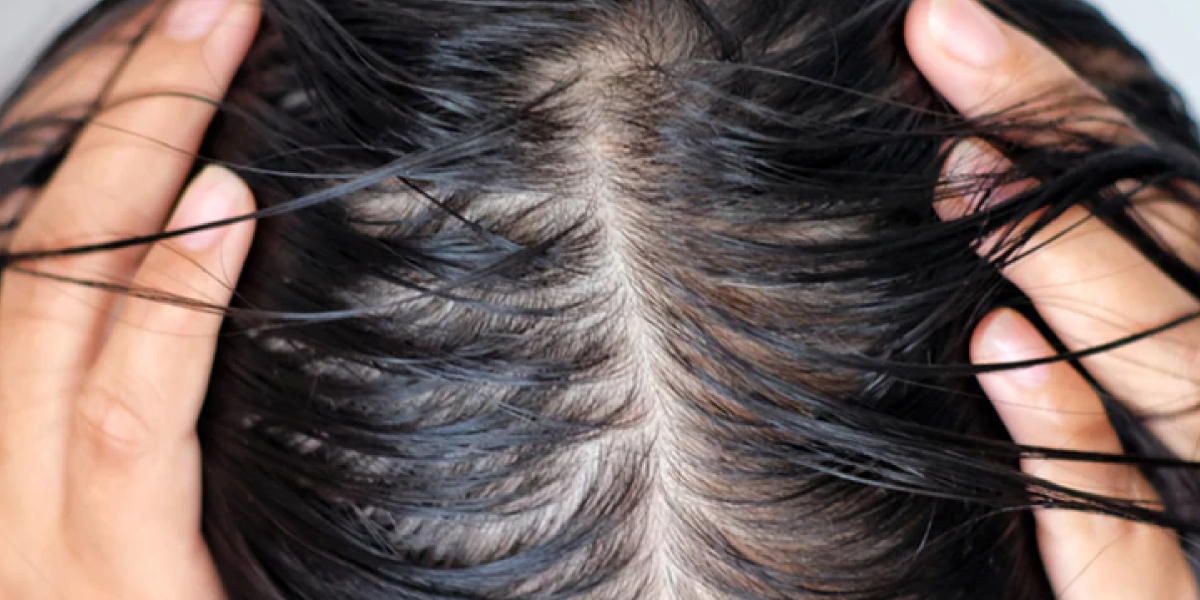 How to Stop Oily Hair